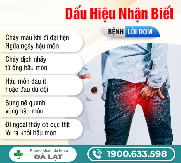 Hình ảnh minh họa